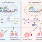 Cancer Res丨哈尔滨医科大学张艳桥团队发现靶向花生四烯酸代谢增强ARID1A缺失型肠癌的免疫治疗效果