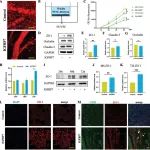 Adv Sci丨北京大学邓旭亮/黄颖团队研究表明延迟给药IGFBP7通过ZO-1依赖性血管稳定改善骨缺损愈合