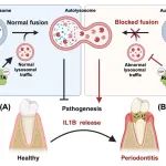 Autophagy丨浙江大学丁佩惠团队解释牙周炎发病新机制