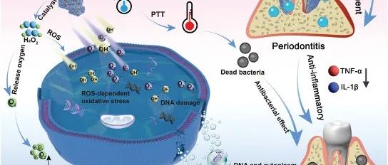 Adv. Healthc. Mater. | 具有抗菌和抗炎作用的微环境响应性纳米酶水凝胶用于治疗牙周炎