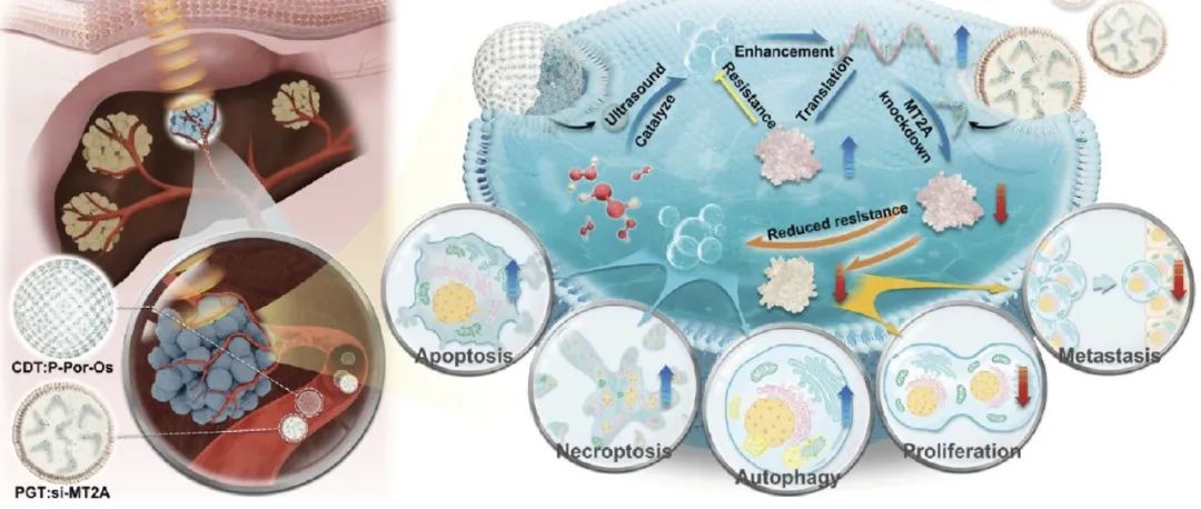 JACS：超声激活人工酶与精准基因治疗协同抑制氧化还原稳态及恶性表型以可控对抗肝细胞癌