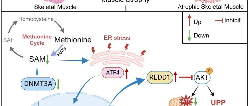 Cell Metabolism | 南京大学王宏伟/黄志强团队发现肿瘤恶液质介导骨骼肌萎缩的新机制