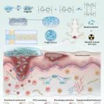 浙江大学周民团队《Biomaterials》：藻蓝蛋白多功能微球用于放射性皮肤损伤治疗