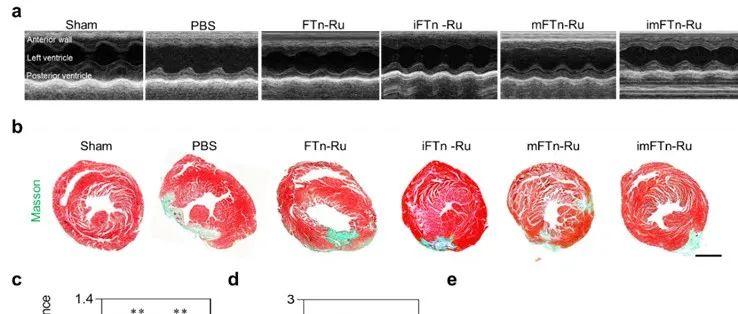 Nano Lett. | 基因工程化线粒体靶向纳米酶的合理设计用于缓解心肌缺血再灌注损伤