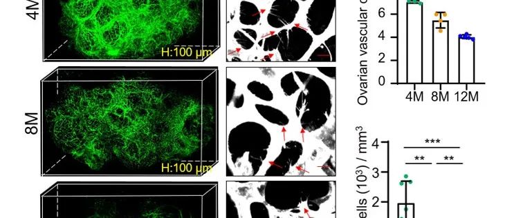 Nat Commun | 张华团队揭示卵巢在中年期生理性功能下降的发生机制并提出改善新策略