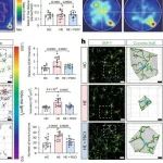 Nature子刊 | 南方医科大学周宏伟等阐明了肝硬化肝性脑病背后的肠脑轴调控机制！