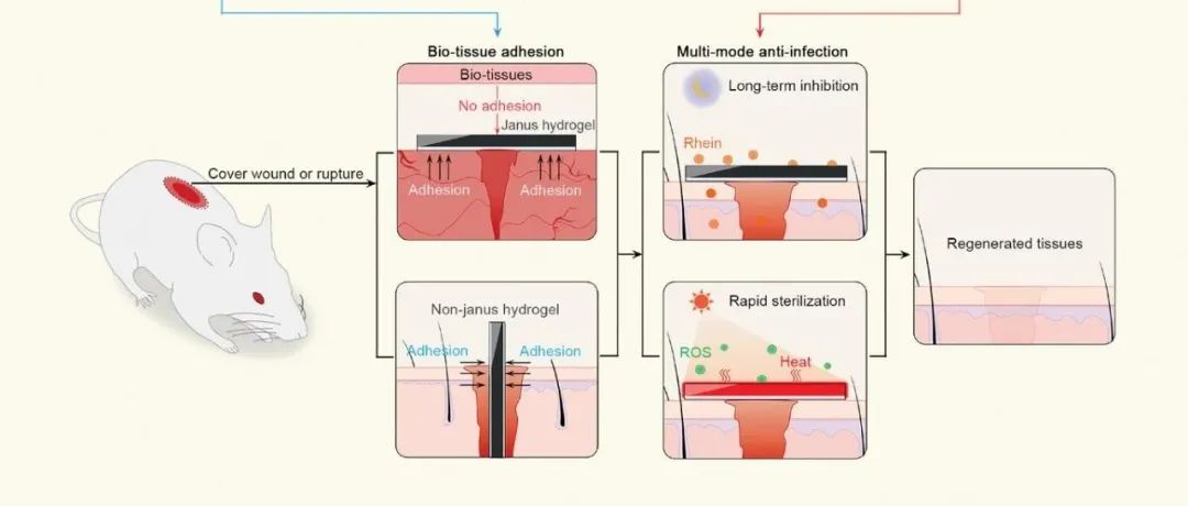 【Adv.Funct.Mater】具有生物黏附性和多模式消毒的定制Janus水凝胶用于多重葡萄球菌感染的开放伤口快速恢复