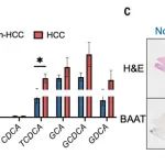 Science | 胆酸合成阻碍肝癌特异性T细胞的免疫响应