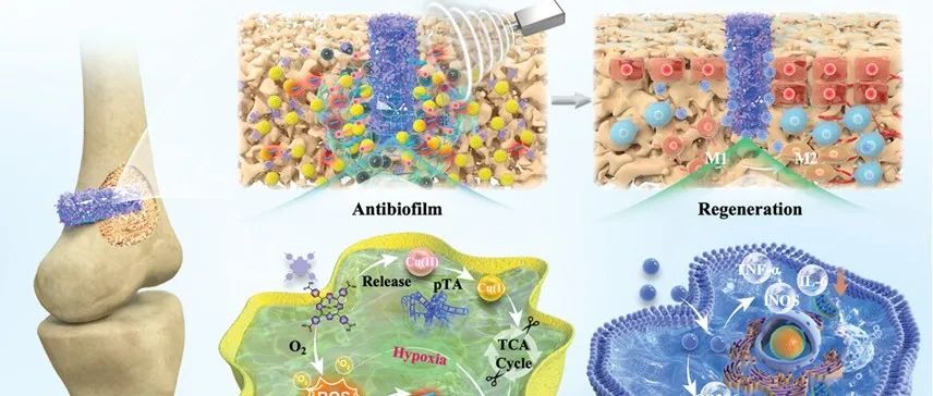 文献分享 | Adv. Mater. |  超声激活的益生菌囊泡涂层通过细菌铜死亡和免疫调节治疗钛植入物感染