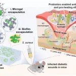 中山大学贾昭君课题组 AHM: “装甲”活体益生菌平台 - 糖尿病感染伤口愈合的创新解决方案