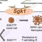 J Hepatol丨复旦大学研究团队表明SGK1的缺失通过促进对T细胞介导的免疫的抵抗支持肝细胞癌中的转移定植