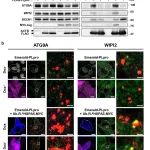 Autophagy | SARS-CoV-2 PLpro泛素去除酶对N-降解信号识别介导的自噬的调控机制研究