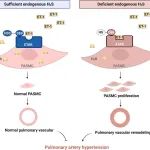 Redox Biology | 北京大学黄娅茜/金红芳团队揭示内源性硫化氢抑制肺动脉高压的新机制