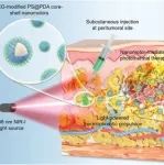 Adv. Mater：具有NIR-II荧光的热泳纳米马达用于实现浅表肿瘤光热治疗
