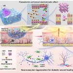 中科院上海硅酸盐所刘宣勇团队 Mater. Today：基于压电增强动电效应的超声响应水凝胶促进神经血管再生加速糖尿病创面愈合