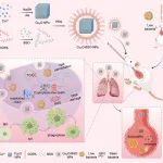 浙江大学周民团队《Adv. Sci.》：吸入式纳米粒子诱导细菌铜死亡用于感染性肺炎治疗