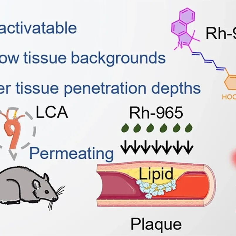 湖南大学张晓兵、宋国胜等：理性设计脂质可激活的近红外二区探针用于精准成像动脉粥样硬化斑块