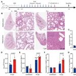 Science子刊丨同济大学徐金富团队发现加重细菌性肺部感染的调控新机制