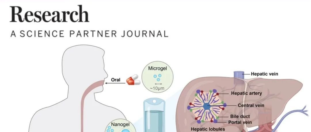 Research综述︱智能水凝胶辅助肝细胞癌治疗的研究新进展—川北医学院附属医院熊永福团队综述