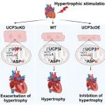 J Mol Cell Cardiol | 中国科学院杨黄恬研究组合作揭示线粒体解偶联蛋白3通过调控天冬氨酸代谢抑制病理性心肌肥厚