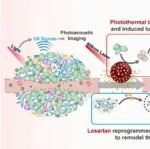 Nano Lett：PTT诱导的反馈碳纳米系统可通过重塑细胞外基质增强乳腺癌治疗