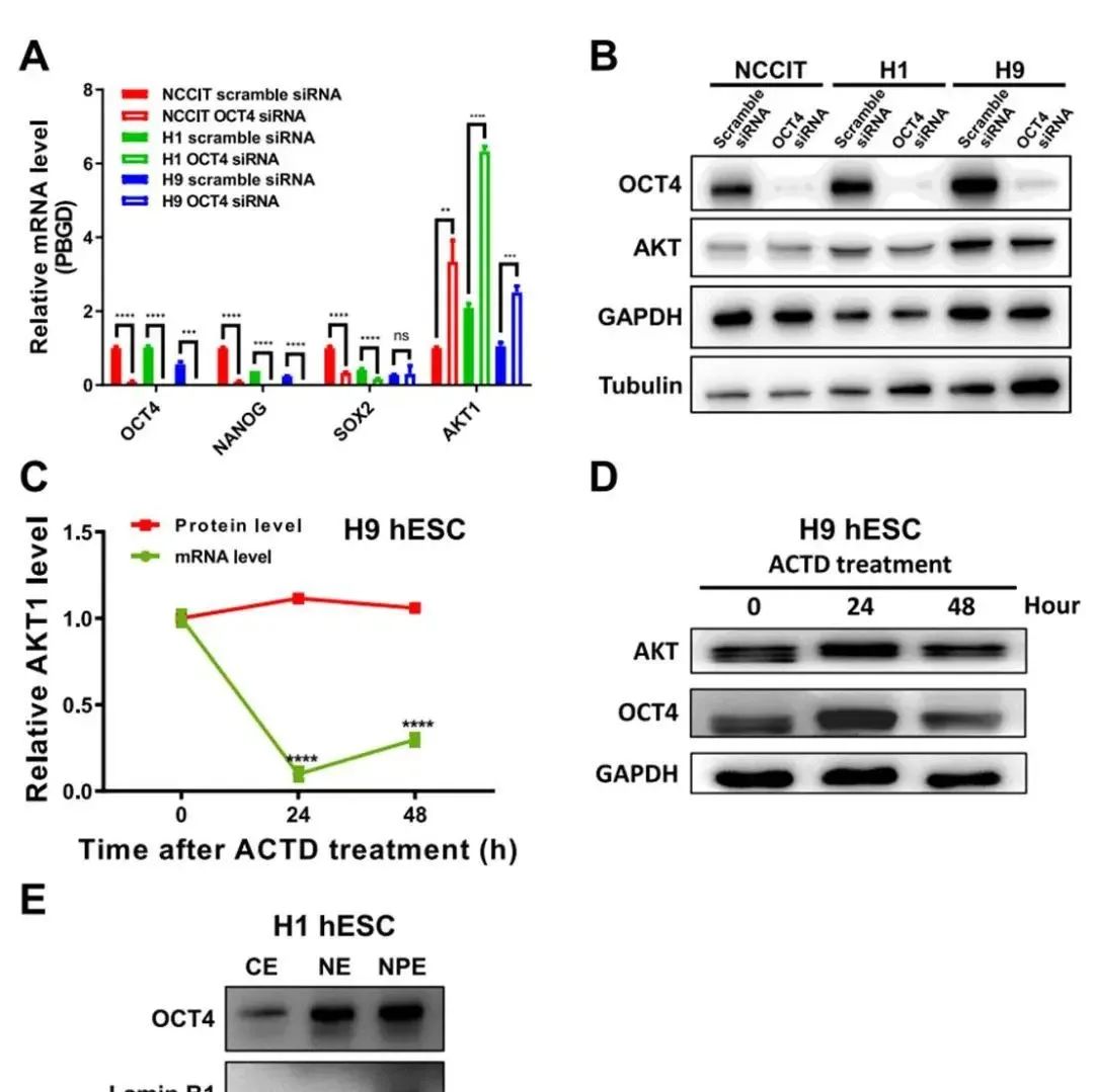 Stem Cell Res Ther | 浙大医学院王英杰/康博、附属邵逸夫医院张松英揭示OCT4可维持多能干细胞稳态