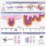 Cancer Cell | 中国医学科学院林东昕等绘制了全球首个食管癌发生发展的单细胞多阶段空间进化图谱