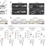 Nature Neurosci | 生物物理所张晓荣等发现线粒体呼吸链缺陷是渐冻症发病机制的关键