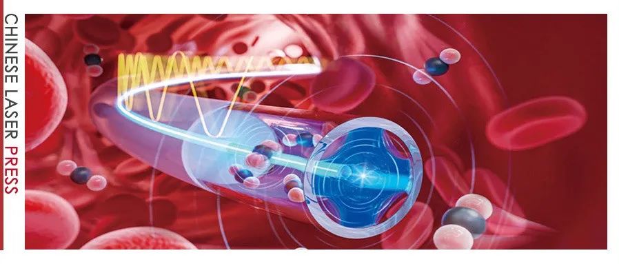 Adv. Photon. | 痕量气体传感器成功“瘦身”：微米级光纤光声光谱仪