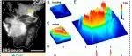 PNAS | 慢性疼痛治疗新靶点！揭示不依赖电信号的神经传递机制