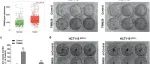 Cell Death Differ | TRIM26通过抑制p53促进结直肠癌生长