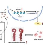 Circ Res | 复旦大学张英梅/任骏/刘硕霖揭示March2调控主动脉瘤/夹层的新机制