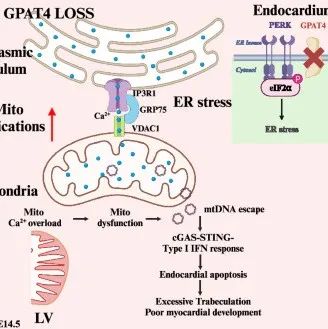 Nat Commun丨南京大学杨中州等团队研究发现GPAT4维持心内膜细胞内质网稳态并保护心脏发育