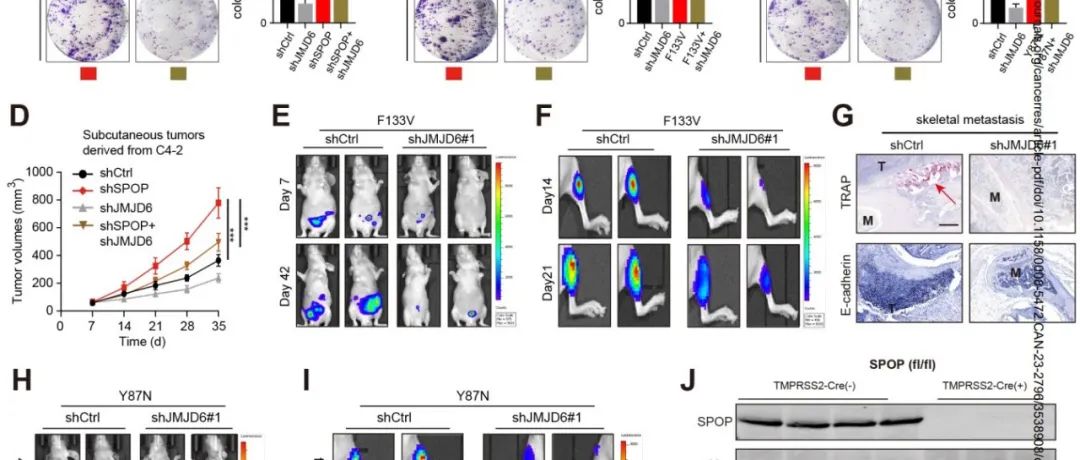 Cancer Res丨上海交通大学徐丹枫等研究确定JMJD6是SPOP突变前列腺癌中可增加对铁死亡诱导剂敏感性的可利用弱点