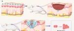 ACS Nano | 四川大学孙强等团队研究发现自供电热电水凝胶加速伤口愈合