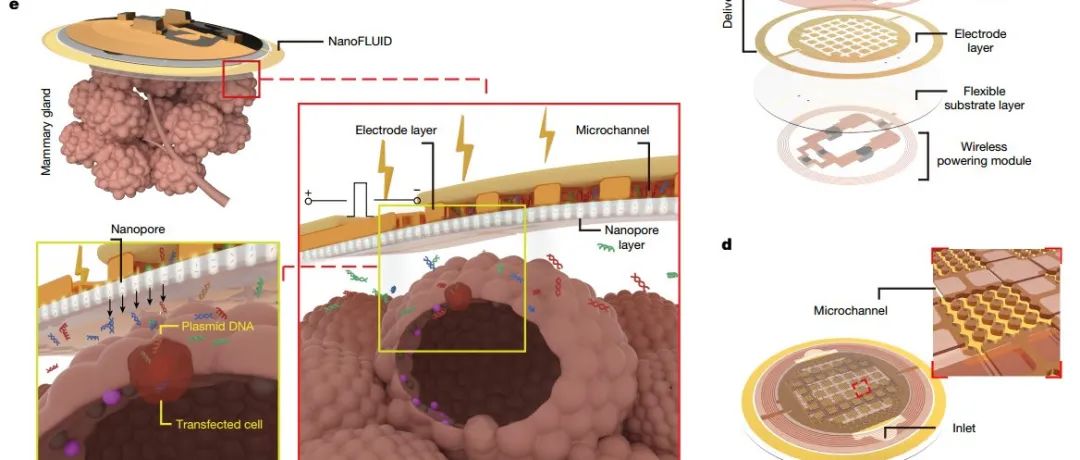 Nature | 北京大学李默等开发一种用于内脏器官的无电池纳米流体细胞内递送贴片！