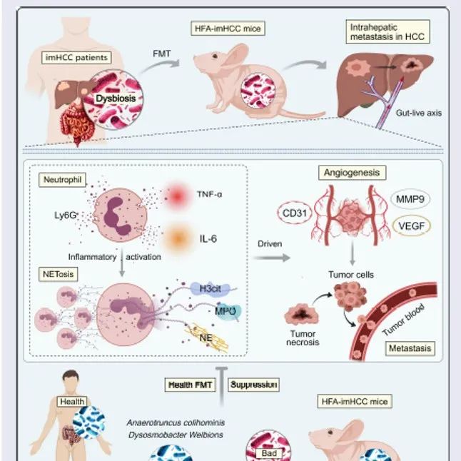 Gut Microbes | 湖南中医药大学田雪飞等揭示肠道菌群失调促进中性粒细胞胞外陷阱驱动肝癌肝内转移