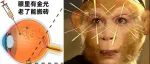 给眼睛注射“金子”治眼病？50岁正是闯的年纪，不能让眼疾耽误了工作