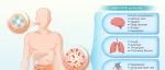The Innovation Medicine | 肠道微生物群对新冠后综合症的影响：病理机制探索与潜在治疗方法