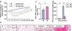 Adv Sci丨中国科学院马娟研究发现缺铁会损害树突状细胞的发育和功能，从而损害宿主的抗感染能力