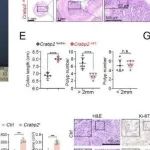 Adv Sci丨南京医科大学孙跃明等团队合作研究揭示了 CRABP2 在 CRC 中的复杂作用机制