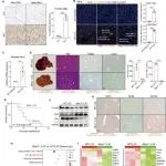 Adv Sci丨同济大学李婧等研究发现Mas信号增强急性肝衰竭小鼠中内皮细胞衍生的S1P诱导的中性粒细胞胞外陷阱形成