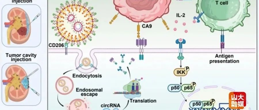 Nature Cancer | 山东大学姜新义/史本康教授团队在实体肿瘤免疫治疗研究方面取得新进展