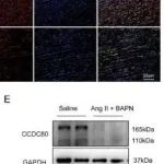 Adv Sci丨上海交通大学沈玲红/何奔研究发现CCDC80通过维持收缩性平滑肌细胞表型来预防主动脉夹层和破裂