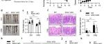 Cell Discovery丨浙江大学白荣盘研究发现心理应激诱导的全身性皮质酮直接破坏肠道干细胞并加剧结肠炎