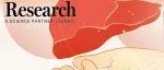 Research|靶向Surf4-SAA1的肝纤维化治疗新策略—山东第一医科大学秦树存课题组与阿尔伯塔大学章大卫课题组合作新进展