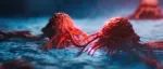 西湖大学郭天南团队联合荷兰Jimenez团队《Cancer Cell》：发布泛癌蛋白质组图谱