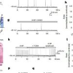 Nat Chem Biol | 中国医学科学院许琪团队研究发现PSPH的药理学抑制减少丝氨酸水平和癫痫发作