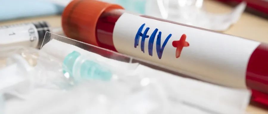 牛津大学团队揭示HIV-1 MA基质层结构成熟并非病毒感染所必需｜Science Advances