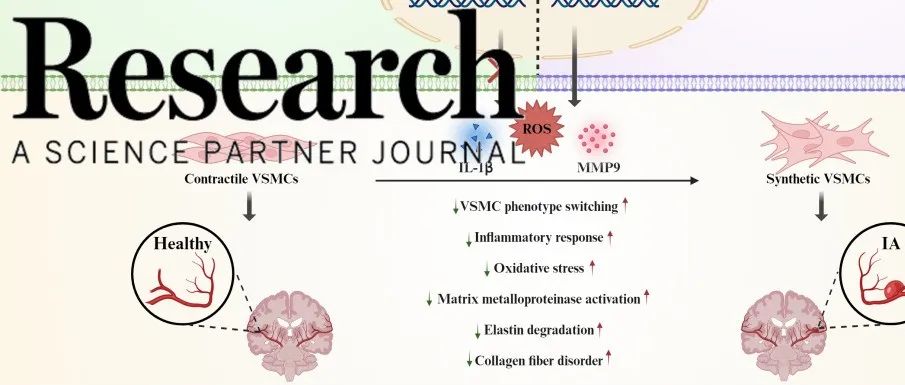 Research|青岛大学附属医院于涛教授和丰育功教授团队合作揭示tsRNA在颅内动脉瘤发病中的功能和作用
